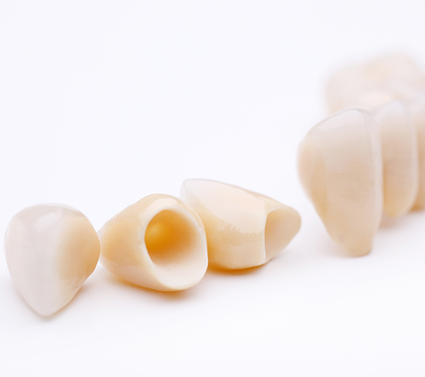 Nampa Dental Crowns and Dental Bridges