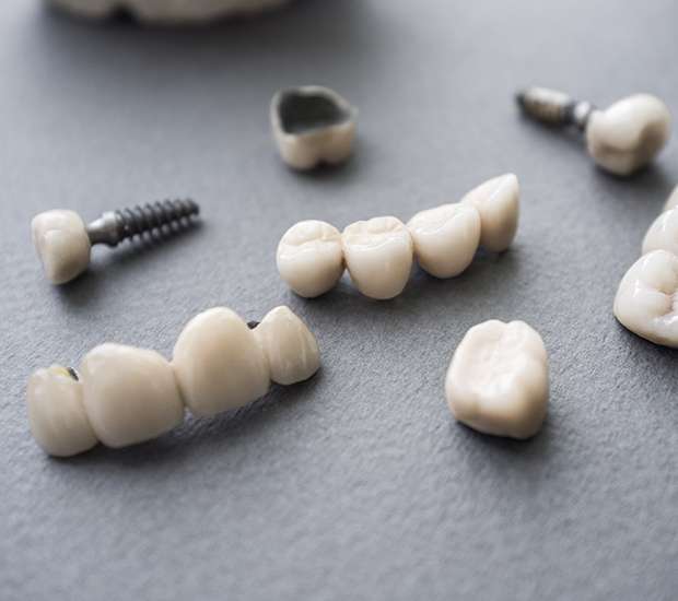 Nampa The Difference Between Dental Implants and Mini Dental Implants
